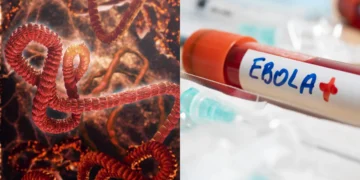 Congo Ebola outbreak 2026